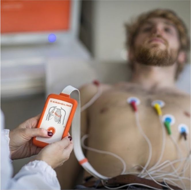 ECG Eletrocardiograma